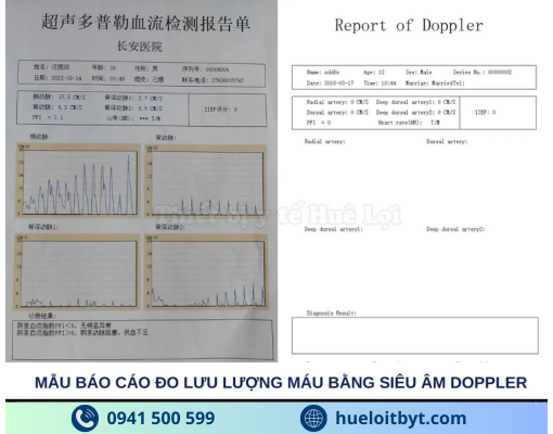 MÁY CHẨN ĐOÁN RỐI LOẠN CHỨC NĂNG TÌNH DỤC NAM GIỚI