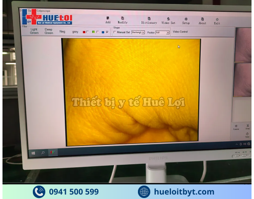 MÁY SOI CỔ TỬ CUNG GIÁ RẺ SW-302