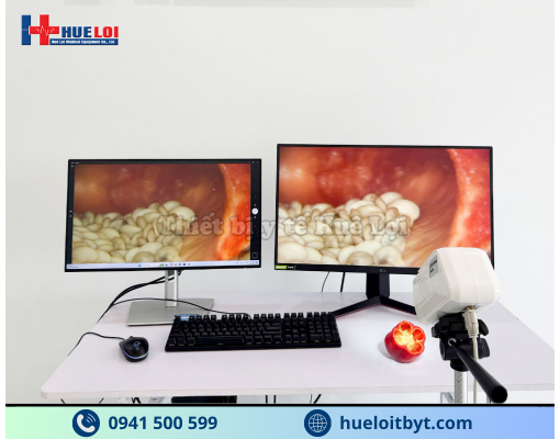 MÁY SOI CỔ TỬ CUNG GIÁ RẺ SW-302