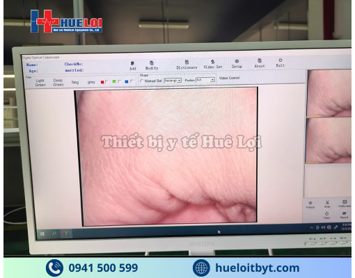 MÁY SOI CỔ TỬ CUNG GIÁ RẺ SW-302