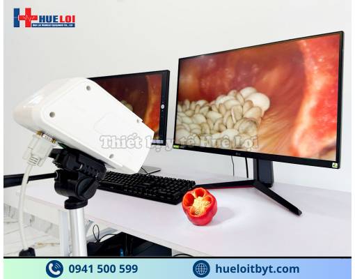 MÁY SOI CỔ TỬ CUNG GIÁ RẺ SW-302