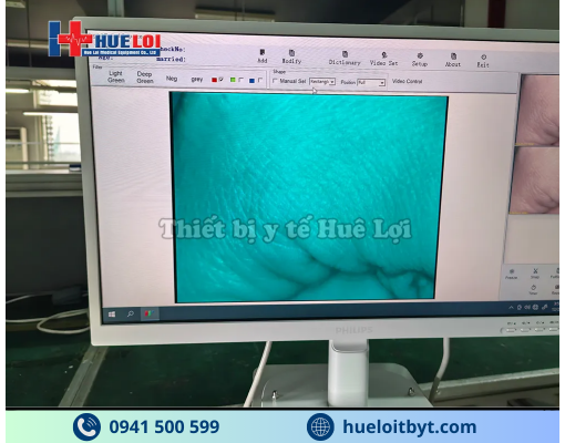 MÁY SOI CỔ TỬ CUNG FULL HD SW-304 GIÁ RẺ