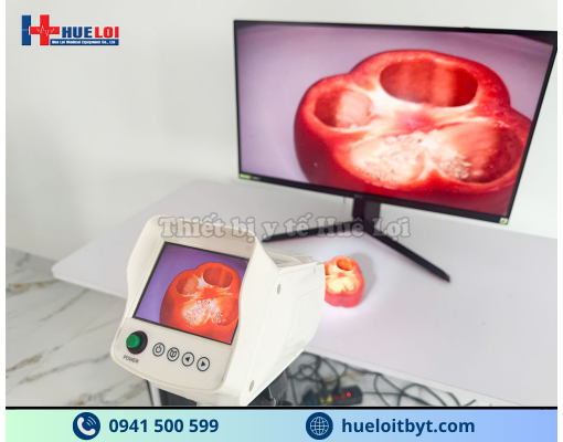 MÁY SOI CỔ TỬ CUNG FULL HD SW-304 GIÁ RẺ