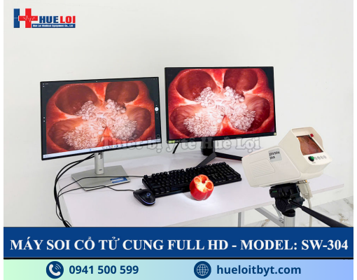 MÁY SOI CỔ TỬ CUNG FULL HD SW-304 GIÁ RẺ
