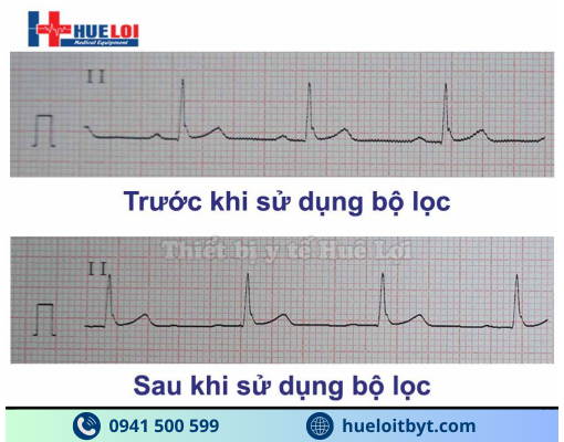 MÁY ĐIỆN TIM 6 KÊNH ECG600G