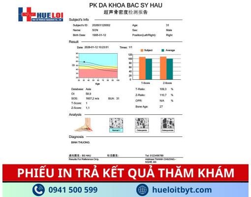 MÁY ĐO LOÃNG XƯƠNG GÓT CHÂN BẰNG SÓNG SIÊU ÂM OSTEOKJ3000 GIÁ TỐT