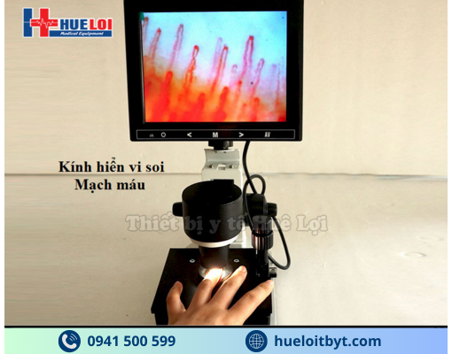 KÍNH HIỂN VI SOI MẠCH MÁU GIÁ RẺ