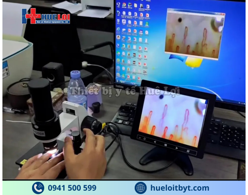 KÍNH HIỂN VI SOI MẠCH MÁU ĐỘ PHÓNG ĐẠI CAO