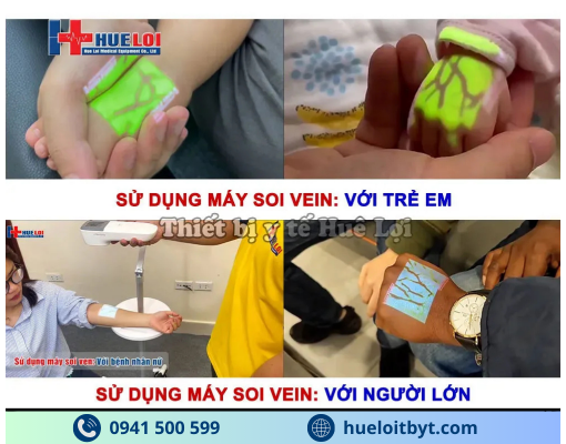 MÁY SOI VEIN CẦM TAY GIÁ RẺ QV-600